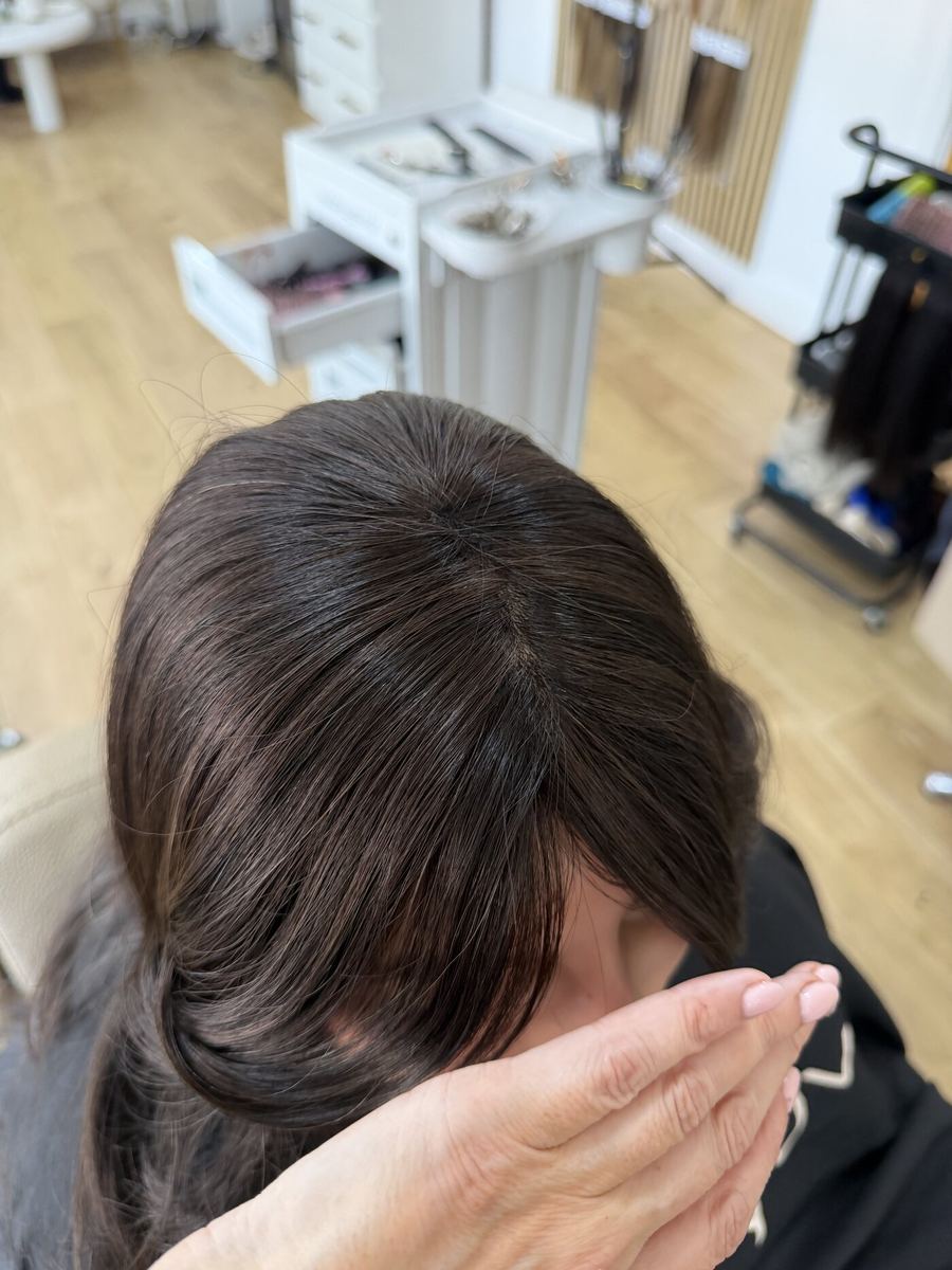 Replica Scalp System natural result at Perfect Tresses Coventry
