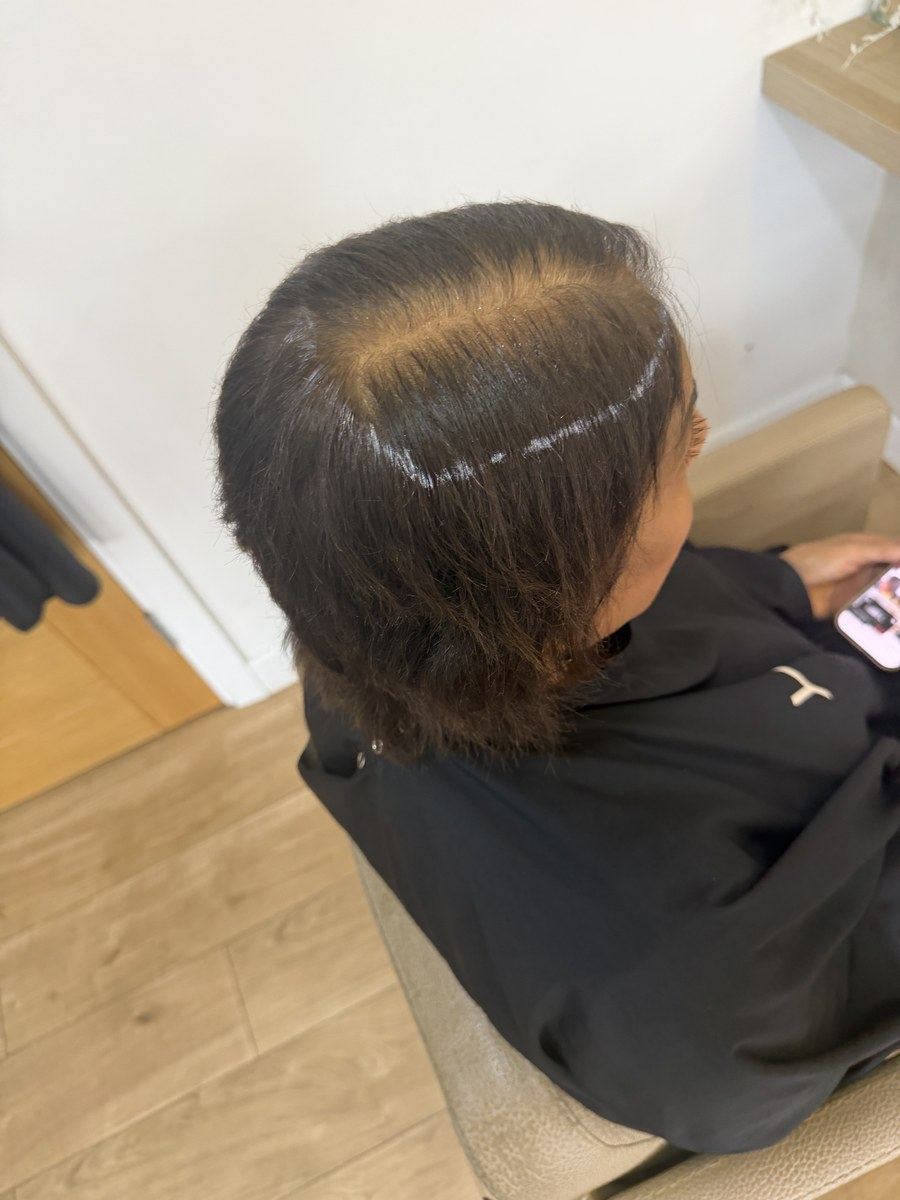 Replica Scalp System fitted at Perfect Tresses Coventry